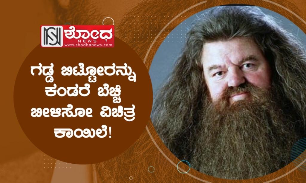 ಗಡ್ಡ ಬಿಟ್ಟೋರನ್ನು ಕಂಡರೆ ಬೆಚ್ಚಿ ಬೀಳಿಸೋ ವಿಚಿತ್ರ ಕಾಯಿಲೆ!