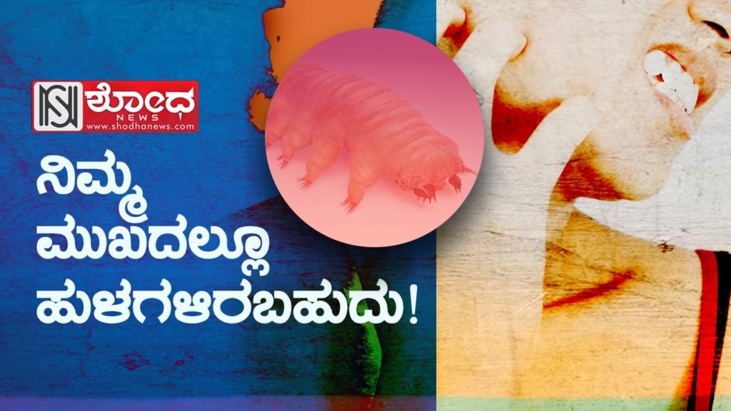 ನಿಮ್ಮ ಮುಖದಲ್ಲೂ ಹುಳಗಳಿರಬಹುದು!